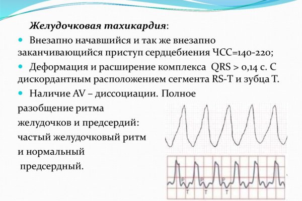 Как перейти на кракен